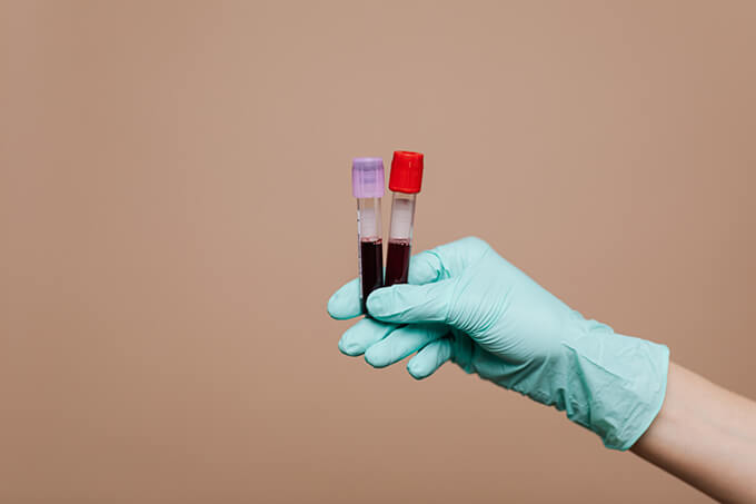 医療 看護 介護 無料 写真 イラスト 素材 ウイルス バイ菌 コロナ COVID 19 血液検査 Blood test