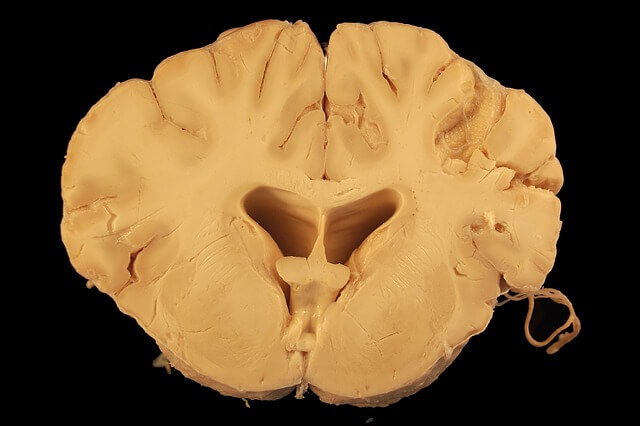 医療 看護 介護 無料 写真 イラスト 素材  人体 臓器 Organs 解剖生理 Anatomical physiology 脳 brain 